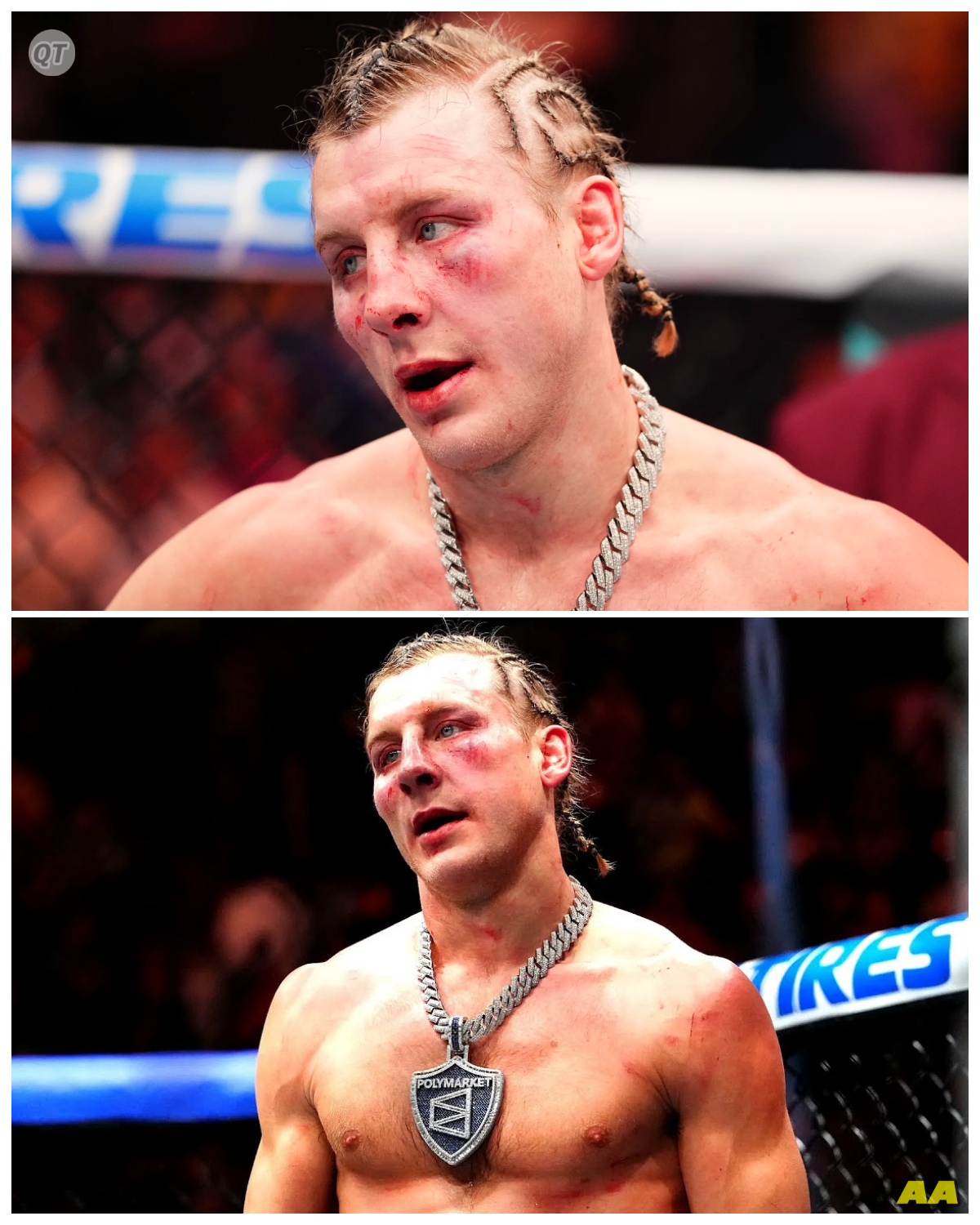 🐘 Paddy Pimblett: The Overhyped Sensation of MMA? 🚨 Can hype lead to unrealistic expectations? Paddy Pimblett has been a polarizing figure in the UFC, with many fans debating whether he was overhyped from the beginning. As his career unfolds, what insights can we gather about the impact of hype on a fighter’s development? What are the key moments that have shaped this discussion? 👇